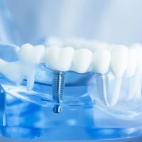 La Habra Advanced Dentistry ico