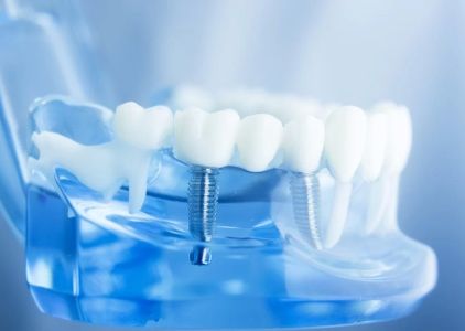 La Habra Advanced Dentistry