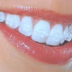 Comprehensive Orthodontic Options for Adults with Bite Problems