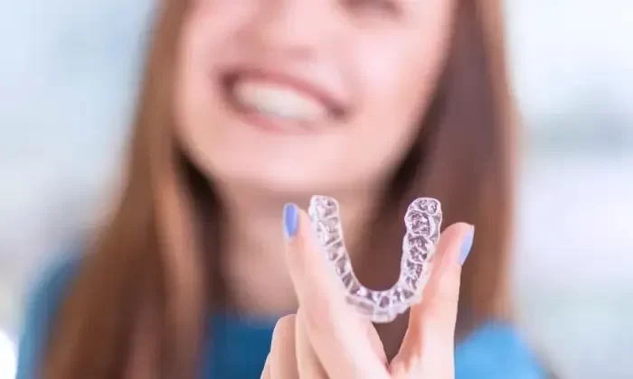 How to Fix an Overbite with Braces: A Comprehensive Guide