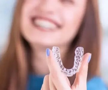 How to Fix an Overbite with Braces: A Comprehensive Guide