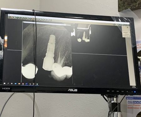 East Valley Periodontics