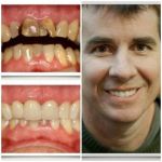 Aspen Ridge Dental Care