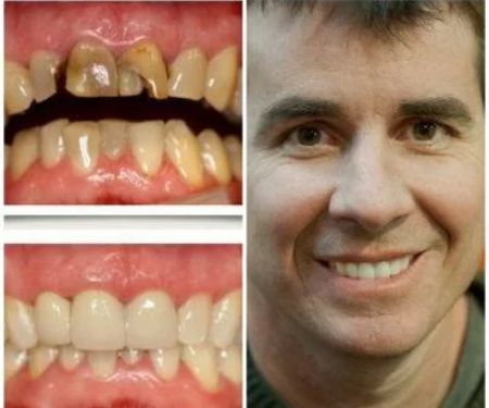 Aspen Ridge Dental Care
