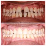 Wade Orthodontics Columbus West