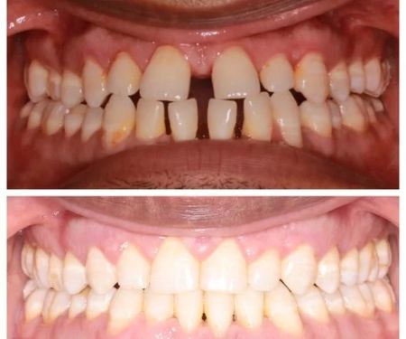 Wade Orthodontics Columbus West