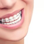 Elison & Wood Orthodontics