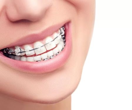 Elison & Wood Orthodontics