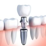 Tru-Value Dental and Denture