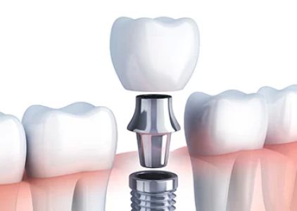 Tru-Value Dental and Denture