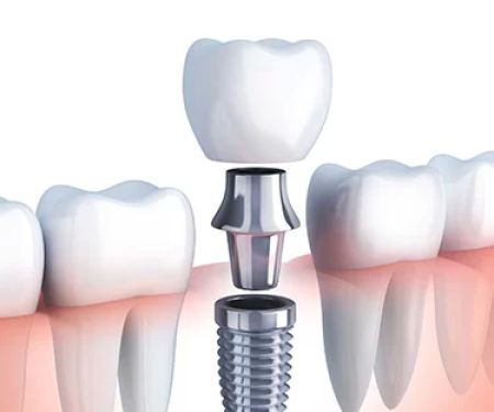 Tru-Value Dental and Denture