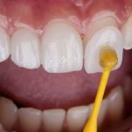 Skyline Dental Studio: Dr. Marjan Fathi, DDS