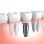 SF Dental