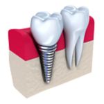 Chanhassen Family Dentistry