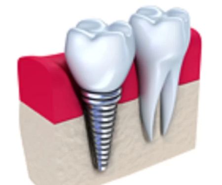 Chanhassen Family Dentistry