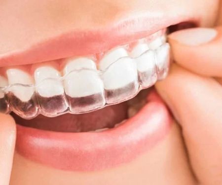 Belmont Orthodontics