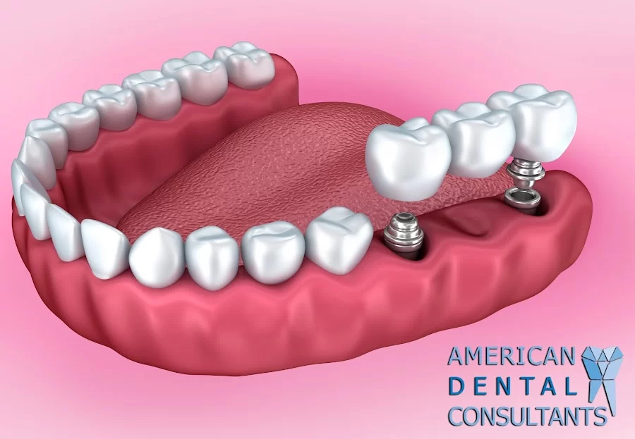 American Dental 7