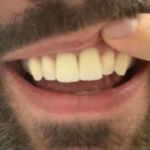 Alpha Dental Somerville