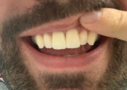Alpha Dental Somerville