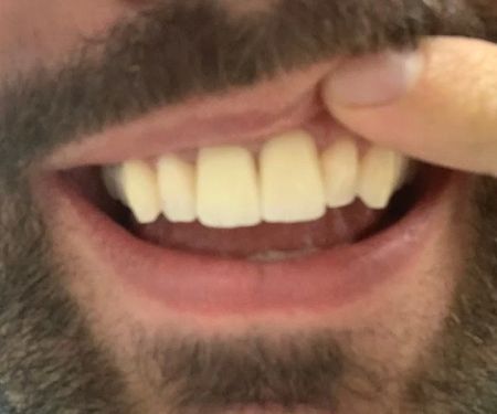 Alpha Dental Somerville