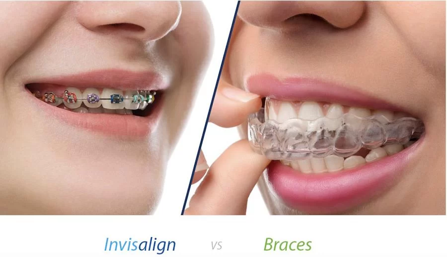 SKY DENTAL Picture 5