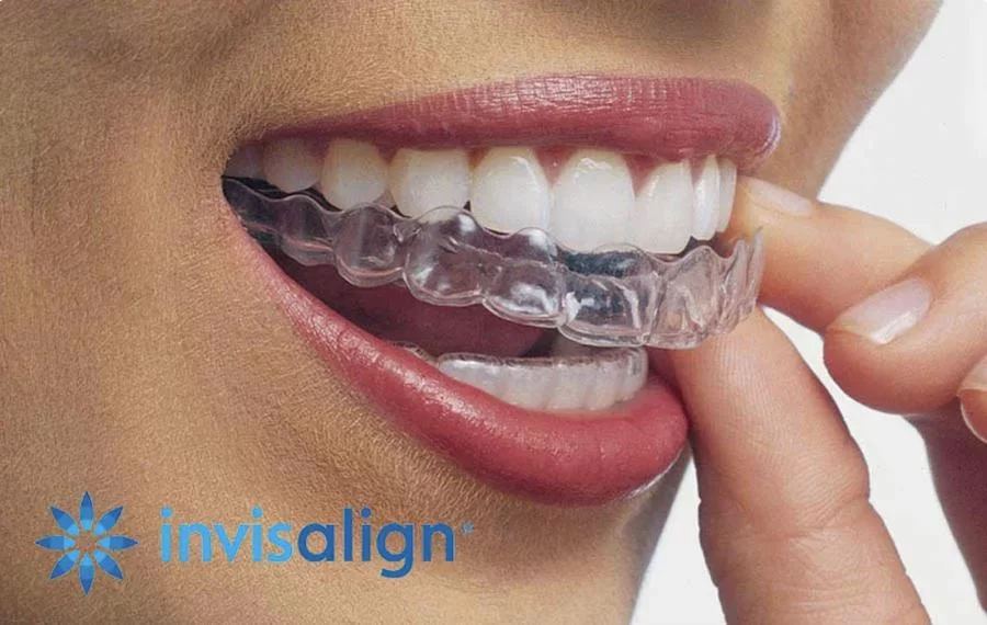 SKY DENTAL Picture 7