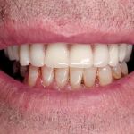 Central Dental Associates