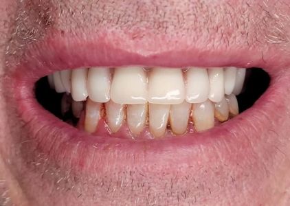 Central Dental Associates