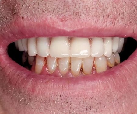 Central Dental Associates