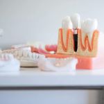 PerioImplant Associates - New Albany, IN