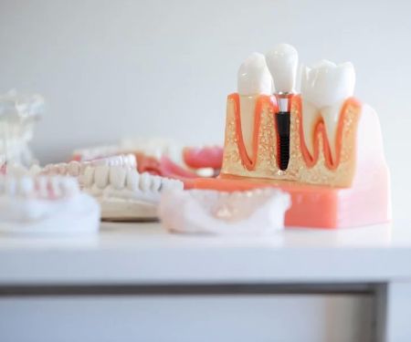 PerioImplant Associates - New Albany, IN
