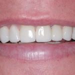 Lakeview Dental Care in Chandler