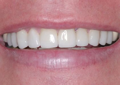 Lakeview Dental Care in Chandler