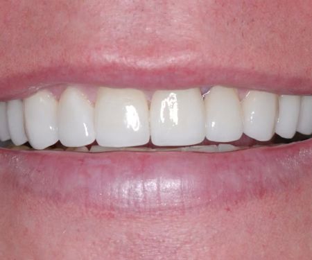 Lakeview Dental Care in Chandler