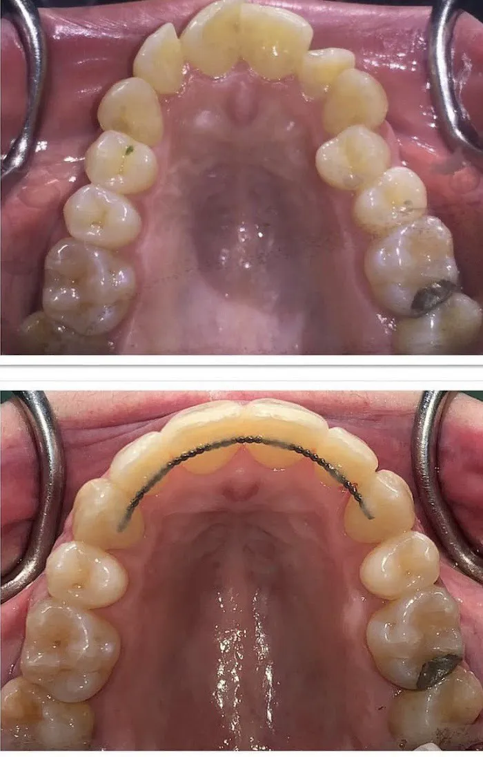 iDent Dental 9