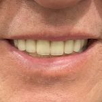 Hi-Dent Dental Laboratory