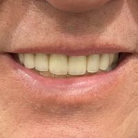 Hi-Dent Dental Laboratory ico