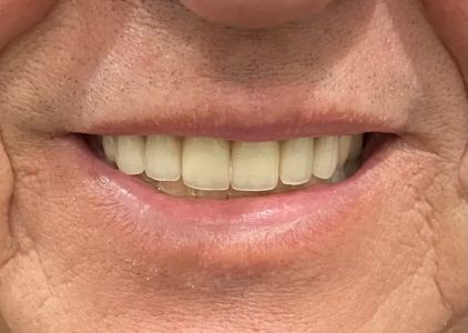 Hi-Dent Dental Laboratory