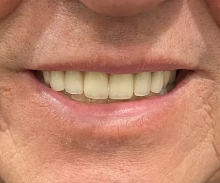 Hi-Dent Dental Laboratory