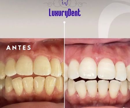 Consultorio Dental Luxurydent (Dentista en Matamoros)