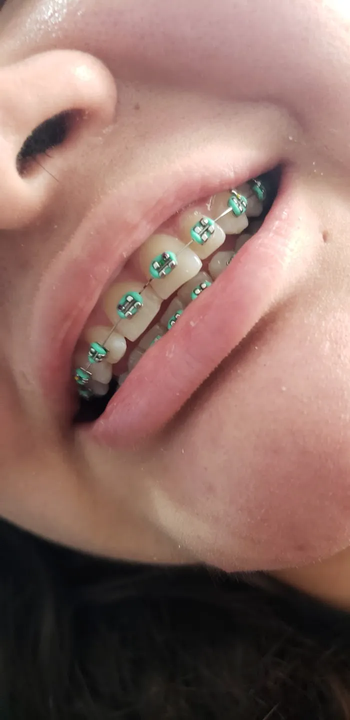 H&L Studio Dental - Dentistas Especialistas - Implantes Dentales (Dentista Matamoros) Picture 10