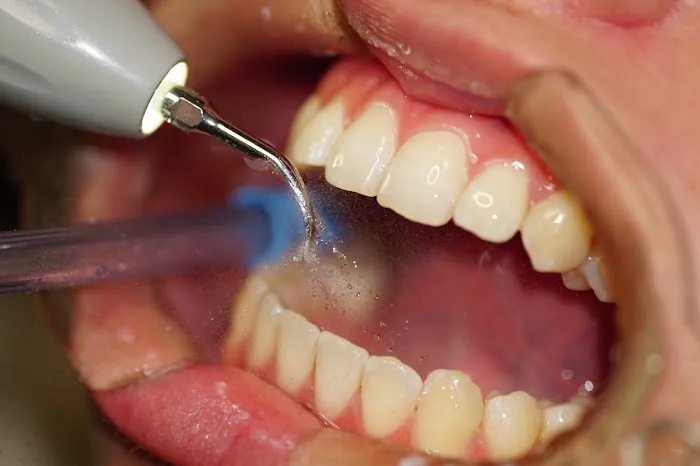 SiSo Dent Picture 7