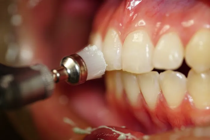 SiSo Dent Picture 1