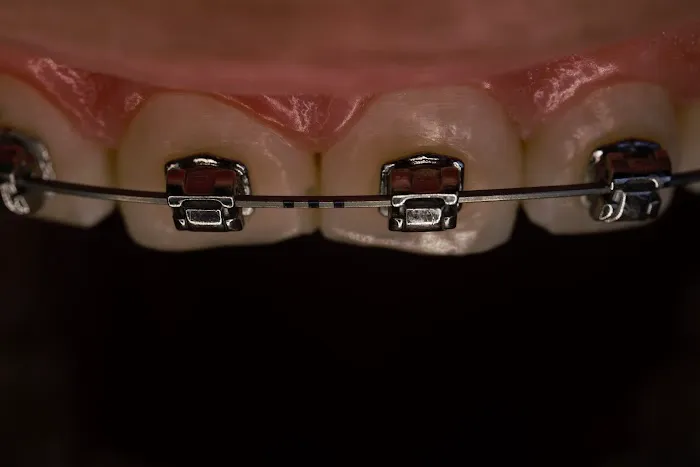 SiSo Dent Picture 6