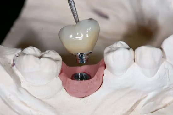 Anchor Family Dentistry Picture 4