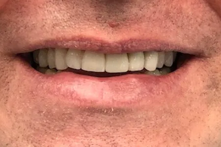 Waterford & Clarkston Dentistry Picture 3