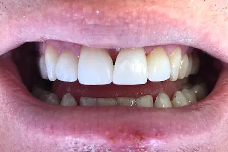 Waterford & Clarkston Dentistry Picture 4