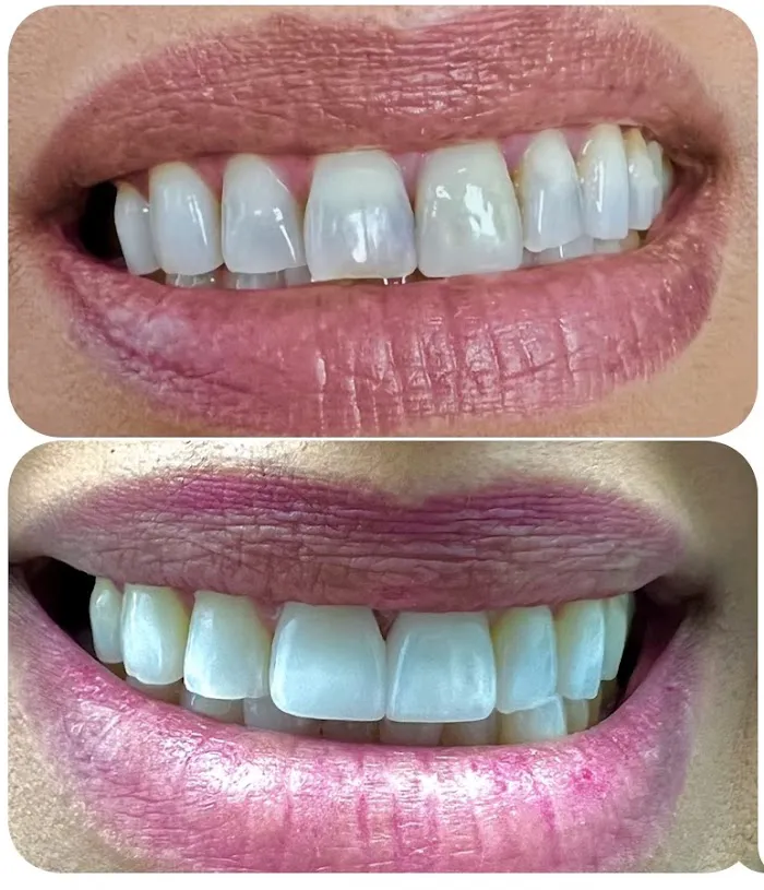 Smile Essentials Dental Care Picture 7