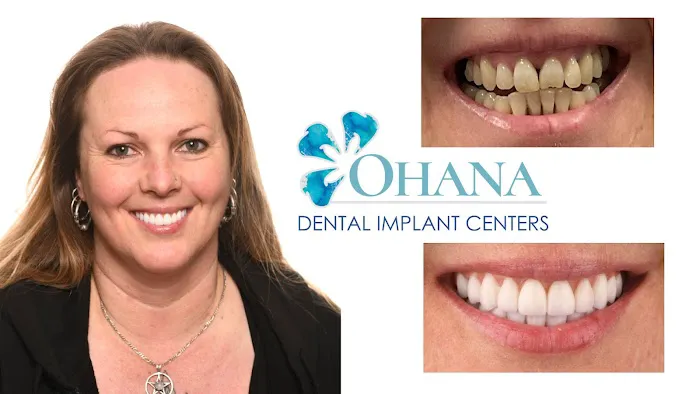 Ohana Dental Implant Centers Picture 5