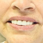Comprehensive Family Dentistry